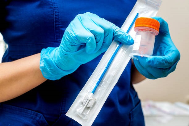 Penyebab Kanker Serviks pada Wanita Faktor Risiko Human Papillomavirus dan Pencegahannya